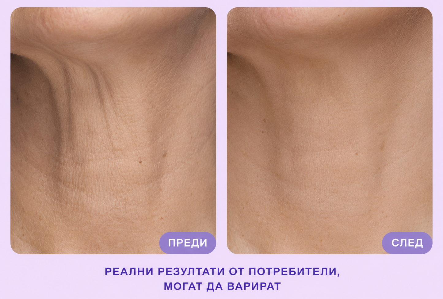 SkinGlow - Крем за стягане и повдигане на шията