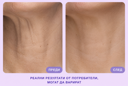 SkinGlow - Крем за стягане и повдигане на шията